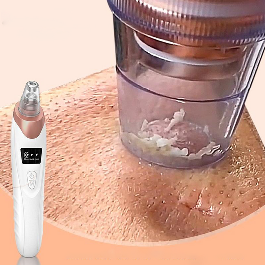 2025 Electric Blackhead Remover Set