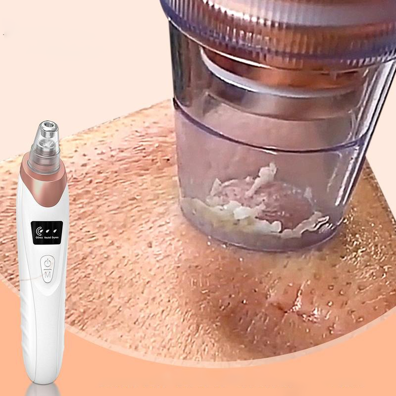 2025 Electric Blackhead Remover Set