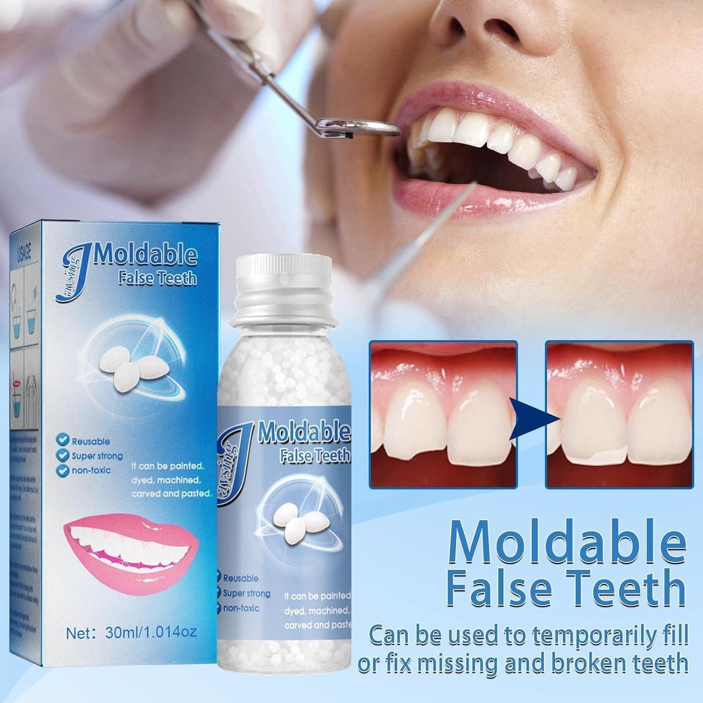 Temporary Dental Restoration Kits